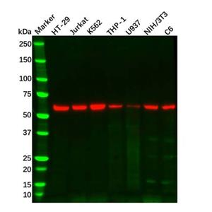 aladdin 阿拉丁 Ab125423 RIP3 Mouse mAb mAb (2013CT892.86.49); Mouse anti Human RIP3 Antibody; WB; Unconjugated