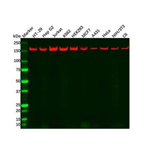 aladdin 阿拉丁 Ab125629 Recombinant ROCK1 Antibody Recombinant (R09-3D3); Rabbit anti Human ROCK1 Antibody; WB; Unconjugated