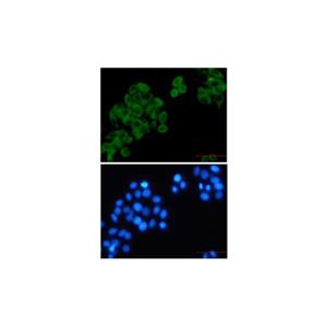 Recombinant RRM1 Antibody,Recombinant RRM1 Antibody