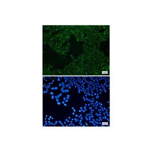 Recombinant SEC61A Antibody,Recombinant SEC61A Antibody