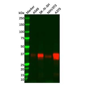 aladdin 阿拉丁 Ab127297 Recombinant SFRP1 Antibody Recombinant (R06-4C7); Rabbit anti Human SFRP1 Antibody; WB; Unconjugated