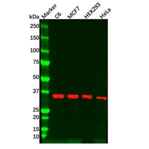 aladdin 阿拉丁 Ab127304 SFRP4 Mouse mAb mAb (5#); Mouse anti Human SFRP4 Antibody; WB,IHC; Unconjugated