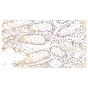 SFRP4 Mouse mAb,SFRP4 Mouse mAb