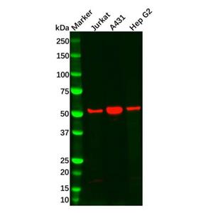 aladdin 阿拉丁 Ab127341 SGK1 Antibody pAb; Rabbit anti Human SGK1 Antibody; WB, ICC, IF; Unconjugated