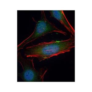 SGK1 Antibody,SGK1 Antibody