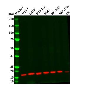 Recombinant SH2D1A/SAP Antibody,Recombinant SH2D1A/SAP Antibody