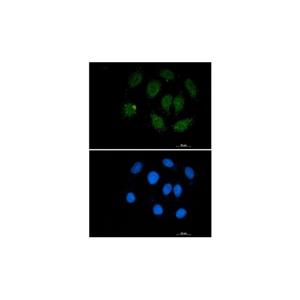 Recombinant SMAD3 Antibody,Recombinant SMAD3 Antibody