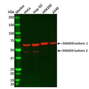 aladdin 阿拉丁 Ab128246 SMAD9 Antibody pAb; Rabbit anti Human SMAD9 Antibody; WB, IHC, IF, ICC; Unconjugated