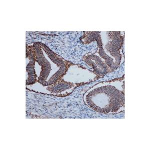 Recombinant ATP1A1 Antibody,Recombinant ATP1A1 Antibody