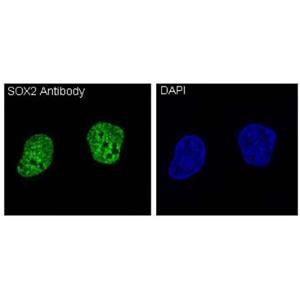 Recombinant SOX2 Antibody,Recombinant SOX2 Antibody