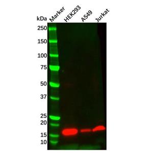 aladdin 阿拉丁 Ab129838 Survivin Mouse mAb mAb (C3); Mouse anti Human Survivin Antibody; WB, IHC; Unconjugated