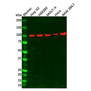 aladdin 阿拉丁 Ab130109 Recombinant TAB3 Antibody Recombinant (R03-7Y2); Rabbit anti Human TAB3  Antibody; WB; Unconjugated