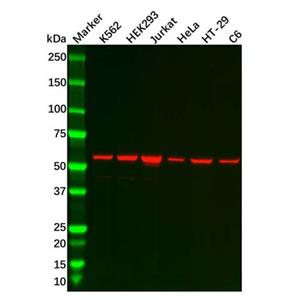 aladdin 阿拉丁 Ab130409 Recombinant TBLR1/TBL1XR1 Antibody Recombinant (R07-3O1); Rabbit anti Human TBLR1/TBL1XR1 Antibody; WB; Unconjugated