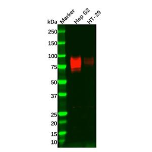 Recombinant TGF beta Receptor II Antibody,Recombinant TGF beta Receptor II Antibody