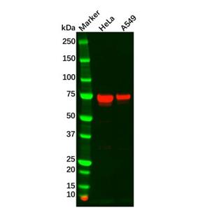 aladdin 阿拉丁 Ab130905 TGFBI Antibody pAb; Rabbit anti Human TGFBI Antibody; WB, IHC; Unconjugated