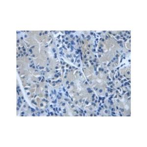 TGFBI Antibody,TGFBI Antibody