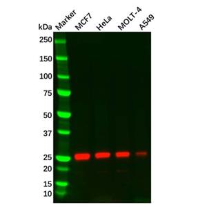 aladdin 阿拉丁 Ab131081 Thymidine Kinase 1/TK1 Mouse mAb mAb (C3); Mouse anti Human Thymidine Kinase 1/TK1 Antibody; WB, ICC, IF; Unconjugated