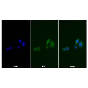 Thymidine Kinase 1/TK1 Mouse mAb,Thymidine Kinase 1/TK1 Mouse mAb