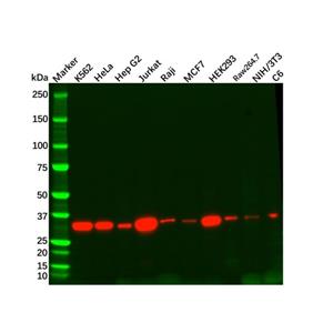 aladdin 阿拉丁 Ab131098 Recombinant Thymidylate Synthase Antibody Recombinant (R08-2F2); Rabbit anti Human Thymidylate Synthase Antibody; WB, IHC, ICC, IF; Unconjugated