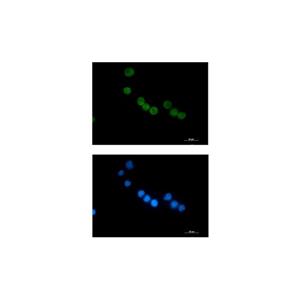 Recombinant Thymidylate Synthase Antibody,Recombinant Thymidylate Synthase Antibody