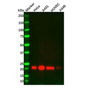 aladdin 阿拉丁 Ab131343 TIMP2 Mouse mAb mAb (1554CT494.262.47); Mouse anti Human TIMP2 Antibody; WB, IHC, ICC, IF, Flow; Unconjugated