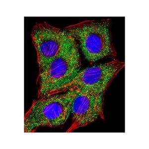 TIMP2 Mouse mAb,TIMP2 Mouse mAb