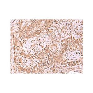 TIP49A Antibody,TIP49A Antibody