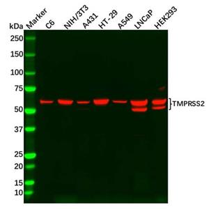 TMPRSS2 Antibody,TMPRSS2 Antibody