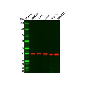 aladdin 阿拉丁 Ab132947 Recombinant TTF1 Antibody Recombinant (R07-3I9); Rabbit anti Human TTF1 Antibody; WB, IHC, ICC, IF; Unconjugated