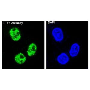 Recombinant TTF1 Antibody,Recombinant TTF1 Antibody