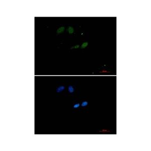 Recombinant UBE2I Antibody,Recombinant UBE2I Antibody