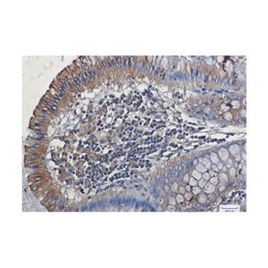 Recombinant VEGF Receptor 1 Antibody,Recombinant VEGF Receptor 1 Antibody