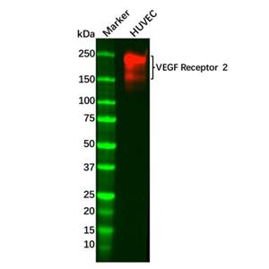 aladdin 阿拉丁 Ab134049 Recombinant VEGF Receptor 2 Antibody Recombinant (R01-3I3); Rabbit anti Human VEGF Receptor 2 Antibody; WB; Unconjugated