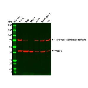 aladdin 阿拉丁 Ab134116 Recombinant VEGFD Antibody Recombinant (R03-8H6); Rabbit anti Human VEGFD Antibody; WB, IHC, ICC, IF; Unconjugated
