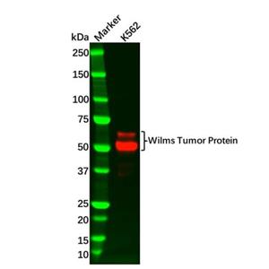 Recombinant Wilms Tumor Protein Antibody,Recombinant Wilms Tumor Protein Antibody