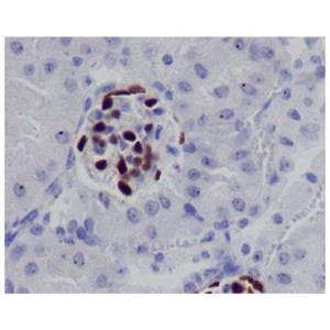 Recombinant Wilms Tumor Protein Antibody,Recombinant Wilms Tumor Protein Antibody