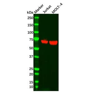 aladdin 阿拉丁 Ab135101 Recombinant ZAP70 Antibody Recombinant (R01-6H7); Rabbit anti Human ZAP70 Antibody; WB; Unconjugated