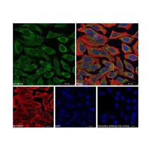 aladdin 阿拉丁 Ab138205 Goat Anti-Rabbit IgG H&L (Alexa Fluor? 488) pAb; Goat Anti-Rabbit IgG H&L (Alexa Fluor? 488); ICC, IF, IHC, Flow, ELISA