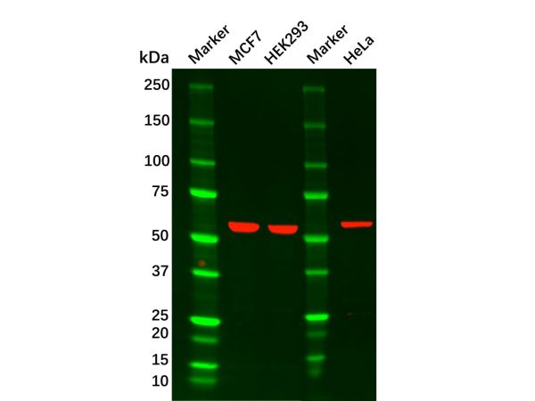 AKT1 Mouse mAb,AKT1 Mouse mAb