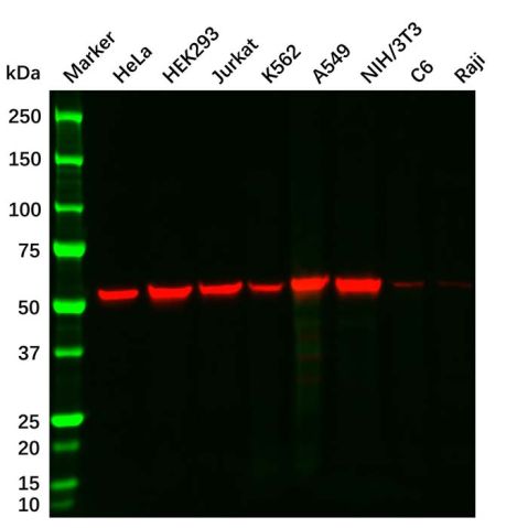 Vimentin Mouse mAb,Vimentin Mouse mAb