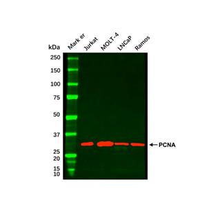 Jurkat Whole Cell Lysate,Jurkat Whole Cell Lysate