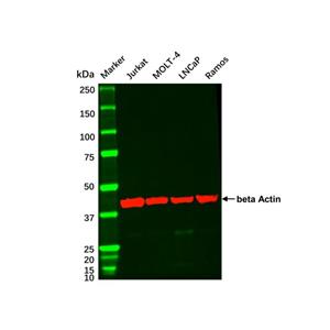 LNCaP Whole Cell Lysate,LNCaP Whole Cell Lysate