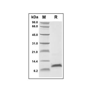 Recombinant Human CCL14 Protein,Recombinant Human CCL14 Protein