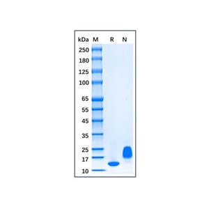 Recombinant Human CCL28 Protein,Recombinant Human CCL28 Protein