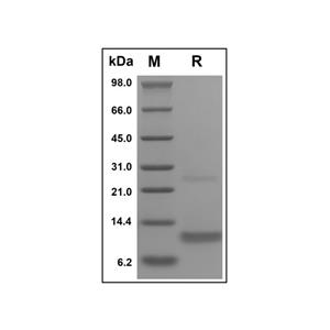 Recombinant Human CCL4/MIP-1 beta Protein,Recombinant Human CCL4/MIP-1 beta Protein