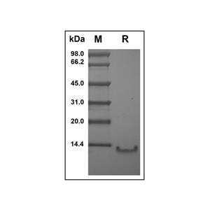 Recombinant Human CCL4L1 Protein,Recombinant Human CCL4L1 Protein