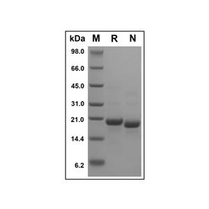 Recombinant Human CD23 Protein,Recombinant Human CD23 Protein