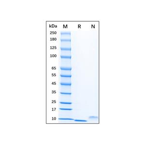 Recombinant Human EGF Protein,Recombinant Human EGF Protein