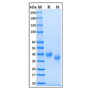 Recombinant Human IL-2 Receptor Alpha Protein,Recombinant Human IL-2 Receptor Alpha Protein