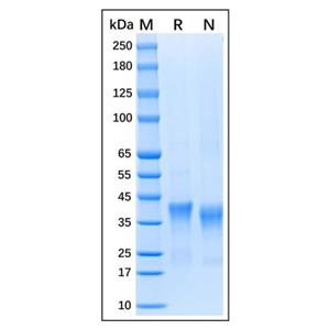 Recombinant Human IL-34 Protein,Recombinant Human IL-34 Protein